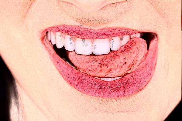 武漢德韓口腔醫(yī)院種植牙哪個(gè)好?種植牙過程會很痛嗎