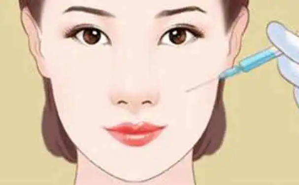 杭州美萊醫(yī)療美容醫(yī)院玻尿酸去皺紋技術(shù)怎么樣?術(shù)后半年案例揭秘|費用多少