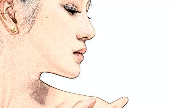 濟(jì)南韓氏外科整形醫(yī)院玻尿酸填充技術(shù)等級怎么樣?術(shù)后案例&價格一覽表