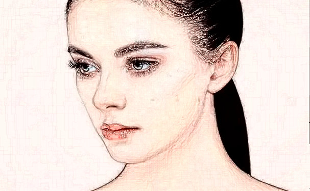 上海馥蘭朵醫(yī)療美容門診部玻尿酸整形填充術(shù)后半年案例欣賞&技術(shù)怎么樣?