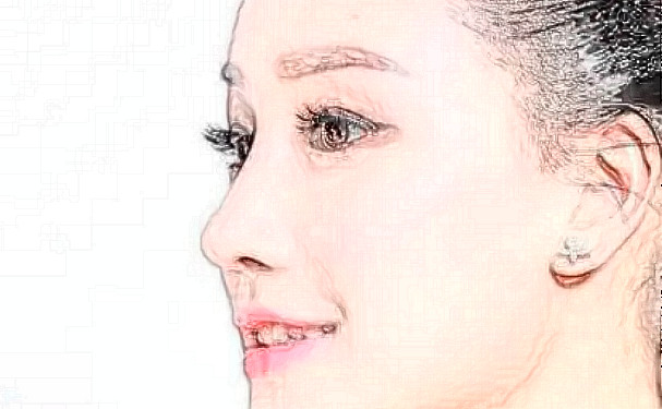 鞍山燕麗美容醫(yī)院抗衰除皺價(jià)目表?技術(shù)評(píng)測(cè)&90天案例揭秘