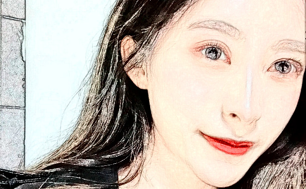 濟(jì)南愛(ài)容整形美容醫(yī)院玻尿酸填充下巴技術(shù)等級(jí)怎么樣?術(shù)后案例&一般多少錢