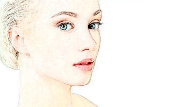 寧波米陽整形醫(yī)院玻尿酸填充臉部術(shù)后半年求美案例|技術(shù)水準怎么樣?價目一覽表