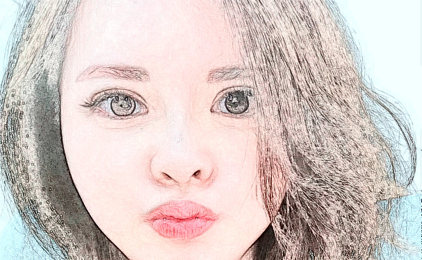 咸寧奧萊整形醫(yī)院除皺技術(shù)怎么樣?收費標準?90天案例曝光