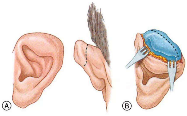 華中科技大學(xué)同濟醫(yī)學(xué)院醫(yī)院杯狀耳整形價格一覽表?技術(shù)風(fēng)格怎么樣?