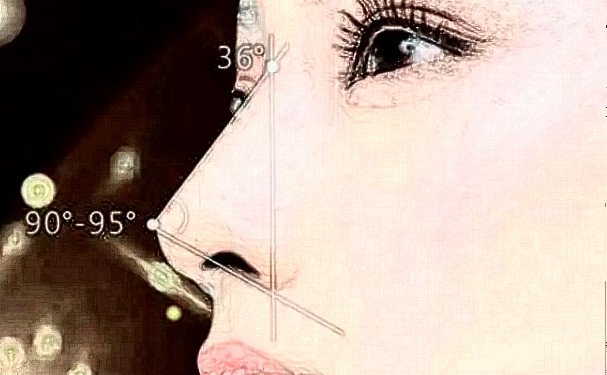 廈門(mén)同安新開(kāi)元醫(yī)院鼻綜合術(shù)后半年案例反饋&技術(shù)怎么樣?