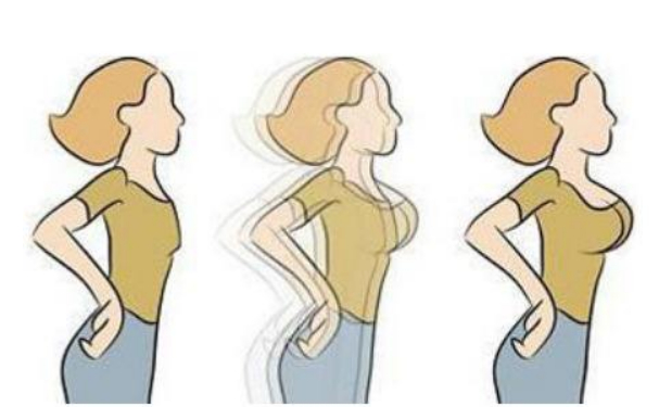 武漢廣愛醫(yī)院隆胸整形怎么樣?費(fèi)用查詢?術(shù)后6個(gè)月案例&技術(shù)亮點(diǎn)