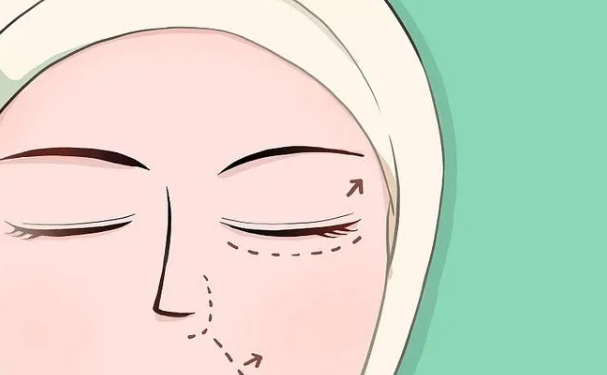 檸悅美容整形做腫泡眼雙眼皮技術(shù)怎么樣?費用查詢?術(shù)后半年案例點評