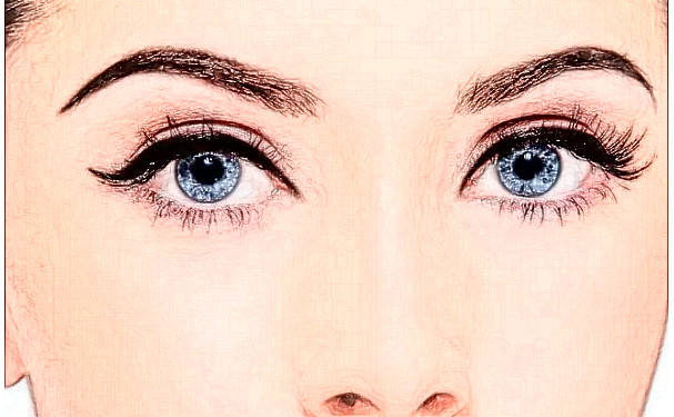 邵陽曹家醫(yī)療美容門診部雙眼皮技術(shù)怎么樣?價(jià)格?術(shù)后半年案例