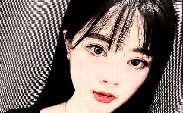 銀川崔大夫博士麗醫(yī)療美容雙眼皮三個(gè)月術(shù)后案例反饋&價(jià)格多少?