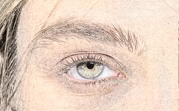 云南武警邊防整形醫(yī)院雙眼皮技術(shù)怎么樣?一般多少錢?三個月案例恢復(fù)過程