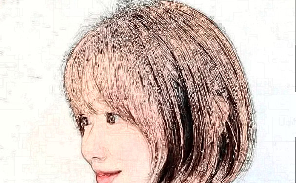 北京中山醫(yī)院種植頭發(fā)怎么樣?價(jià)格?術(shù)后90天案例&技術(shù)亮點(diǎn)