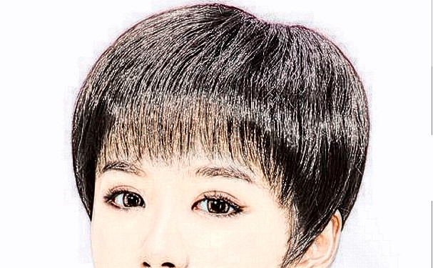 碧蓮盛美學(xué)植發(fā)(寧波分院)植發(fā)120天野生案例|技術(shù)評(píng)價(jià)怎么樣?價(jià)格查詢