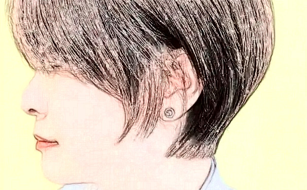 南陽華美醫(yī)療美容門診部植發(fā)120天術(shù)后恢復(fù)案例|技術(shù)優(yōu)勢怎么樣?價格多少