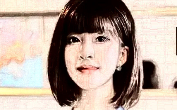 青島熙朵醫(yī)療美容診所植發(fā)術(shù)后三個(gè)月案例曝光&技術(shù)怎么樣?