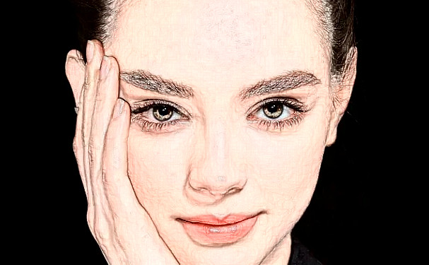 Loveme樂美整形臉部脂肪填充技術怎么樣?術后半年案例點評|費用多少