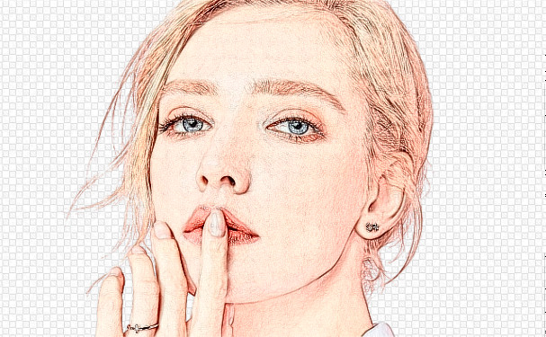 重慶沙坪壩星藝美醫(yī)療美容門診部脂肪填充整形術(shù)后一年求美案例&需要多少錢?