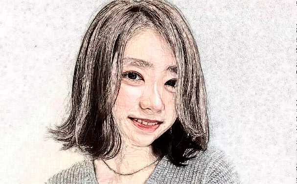 北京東方和諧醫(yī)療美容診所脂肪填充術(shù)后半年案例揭秘&技術(shù)怎么樣?