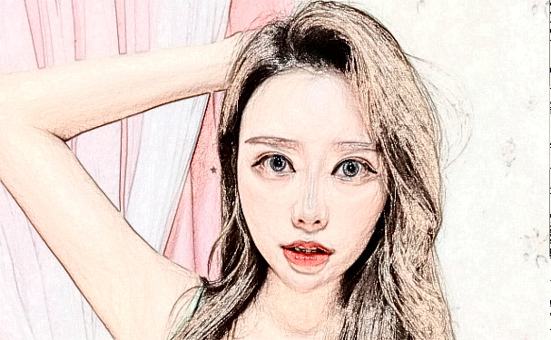 泉州豐澤西華醫(yī)療美容門診部臉部脂肪填充費用明細(xì)?術(shù)后三個月案例反饋