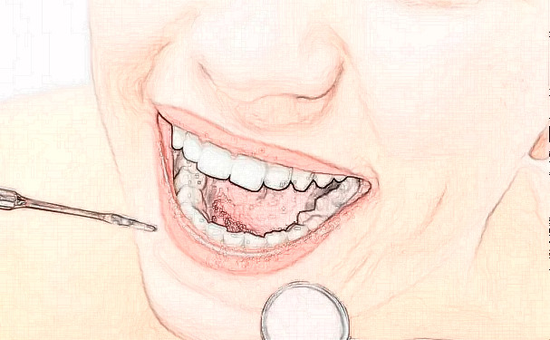 北京天壇醫(yī)院白保晶種植牙技術(shù)優(yōu)勢怎么樣?經(jīng)驗案例