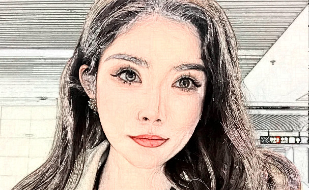 成都藝星謝雯玻尿酸隆鼻三個月野生案例&技術(shù)特色介紹