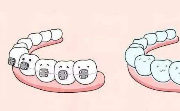 廣元市中心醫(yī)院牙齒歪斜矯正醫(yī)生排名,技術(shù)評(píng)測&醫(yī)院優(yōu)勢