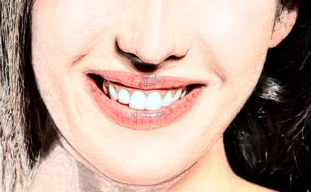 杭州口腔醫(yī)院范豐燕牙齒矯正技術(shù)怎么樣?需要多少錢(qián)?效果詳情