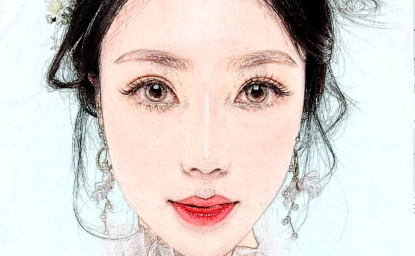 湘雅常德醫(yī)院開雙眼皮醫(yī)生排名,技術級別?術后120天案例