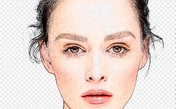 運(yùn)城市中心醫(yī)院岳長(zhǎng)路太陽(yáng)凹陷整形手術(shù)術(shù)后案例&價(jià)格明細(xì)?