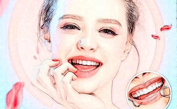 暨南大學(xué)附屬口腔醫(yī)院種植牙價格查詢?技術(shù)點評_口碑詳情