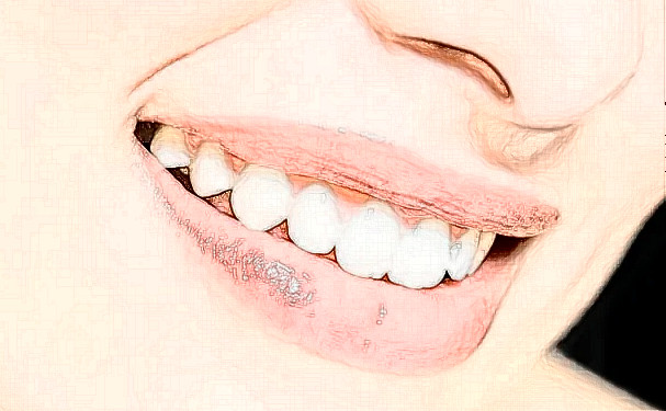 新泰市中醫(yī)醫(yī)院正畸技術(shù)怎么樣?多少錢(qián)?實(shí)力案例