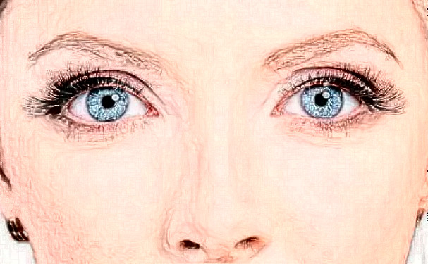 南通市中醫(yī)院叢綱新月雙眼皮術(shù)后120天案例|技術(shù)水準(zhǔn)怎么樣?醫(yī)院實力分析