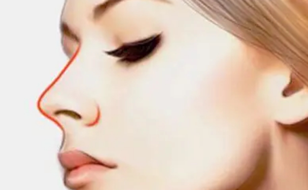 河北醫(yī)科大學第三醫(yī)院耳軟骨隆鼻醫(yī)生排名,技術(shù)特色?野生案例