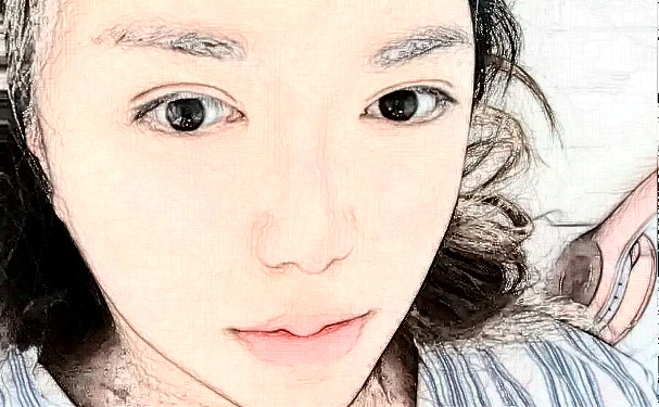 皮膚病醫(yī)院黃莉明v臉整形手術(shù)技術(shù)怎么樣?價(jià)格表?案例曝光