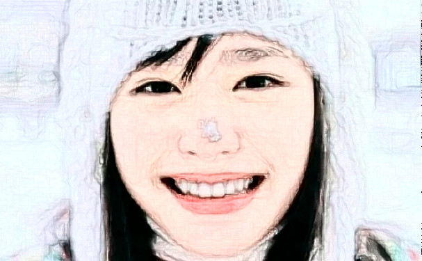 鄭州大學第一附屬醫(yī)院鄭東院區(qū)唐曉娟去眼角細紋案例細節(jié)&價格一覽表?