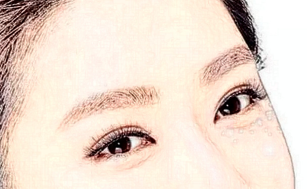 清遠市人民醫(yī)院埋線雙眼皮技術(shù)怎么樣?專家資料