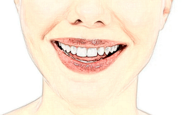 萬年縣人民醫(yī)院何永久金屬自鎖牙套正畸技術怎么樣?一般多少錢?醫(yī)院資料